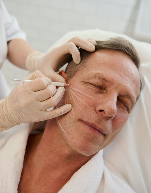 lifting-facial-santiago-de-compostela-hombre